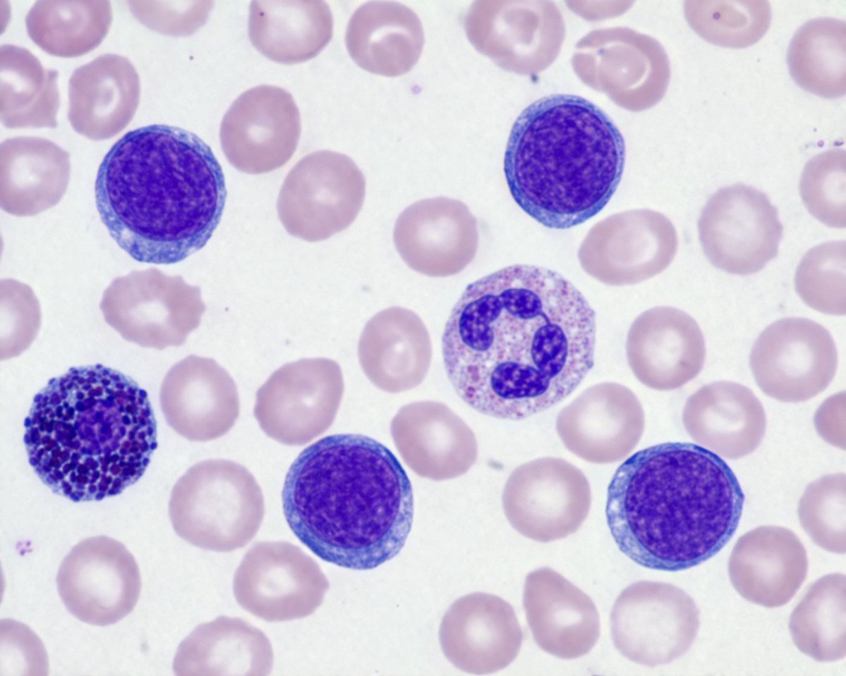 Biological Specimen Microscopy Prompt Qwen Image prompt example: A scientific prompt for generating realistic microscopic images of blood smears with Giemsa staining.