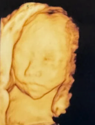 4D Ultrasound to Newborn Portrait reference image 1
